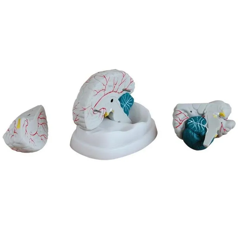 Modelo Dissecção Do Cérebro Humano (3 Peças) Pintado