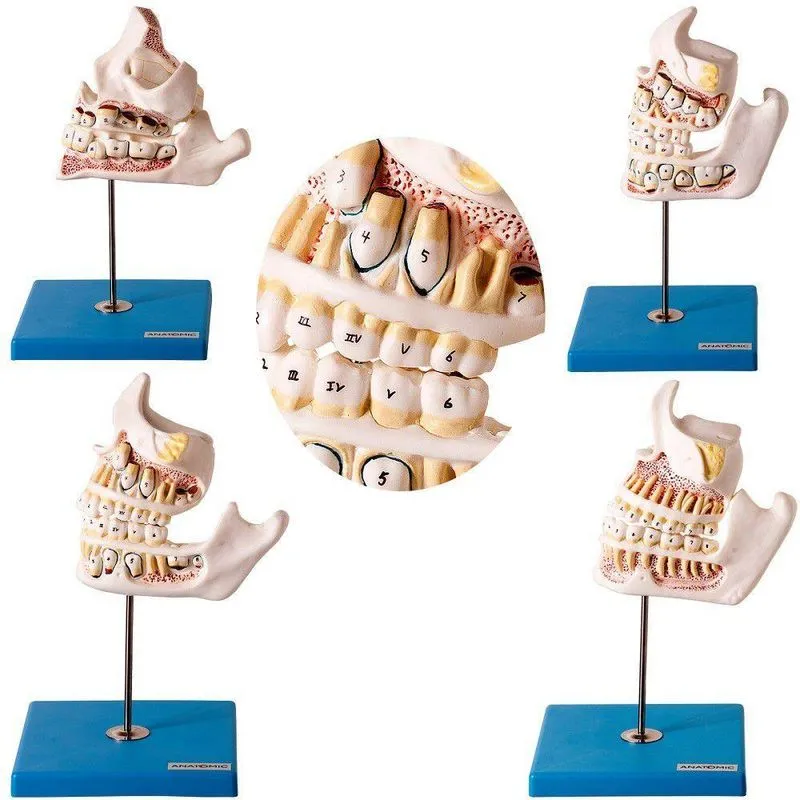 Dentição Em 4 Peças Desenvolvimento Dos Dentes