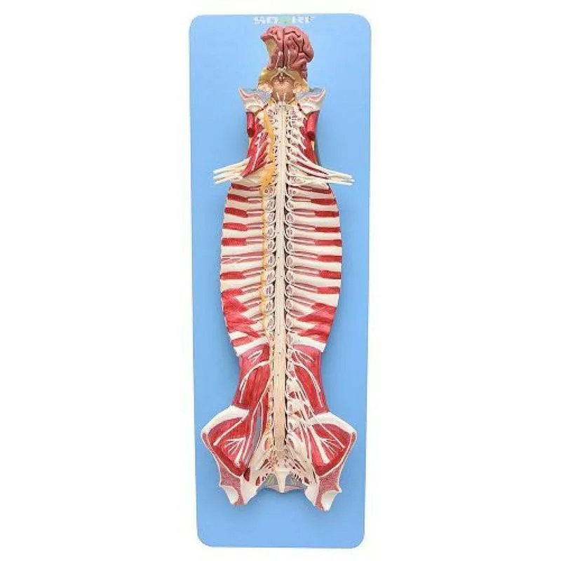 Tronco Cerebral Espinhal Natural