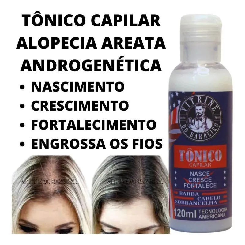10x Tratamento Capilar Para Calvície Tônico Anti Alopécia A