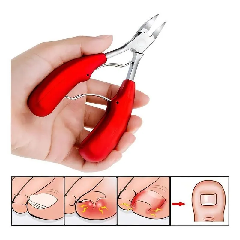 Ideal Profissional N4 Alicate Desencravador De Unha Pé Mano