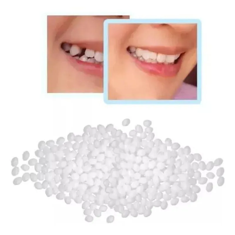 Massa Restauração Dente, Tampa Buraco Dental. Provisórios