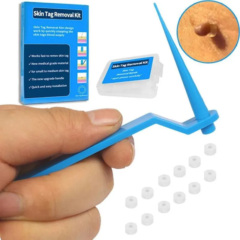 Kit Removedor Verruga Manual 10Un Limpeza Pele Sem Dor