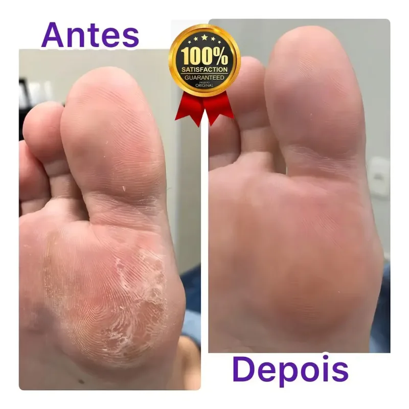 Creme Sebo De Carneiro 200g - Anti Ressecamento E Rachaduras Rhenuks Cosméticos Hidratante Sebo De Carneiro Creme - CORPOSHOPP