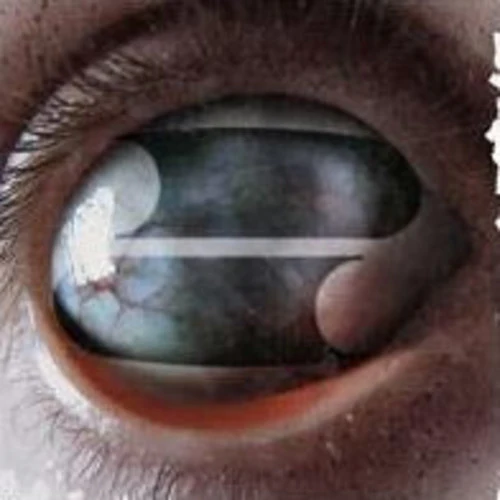 CRAZY EYES