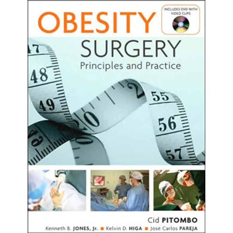 OBESITY SURGERY - PRINCIPLES AND PRACTICE
