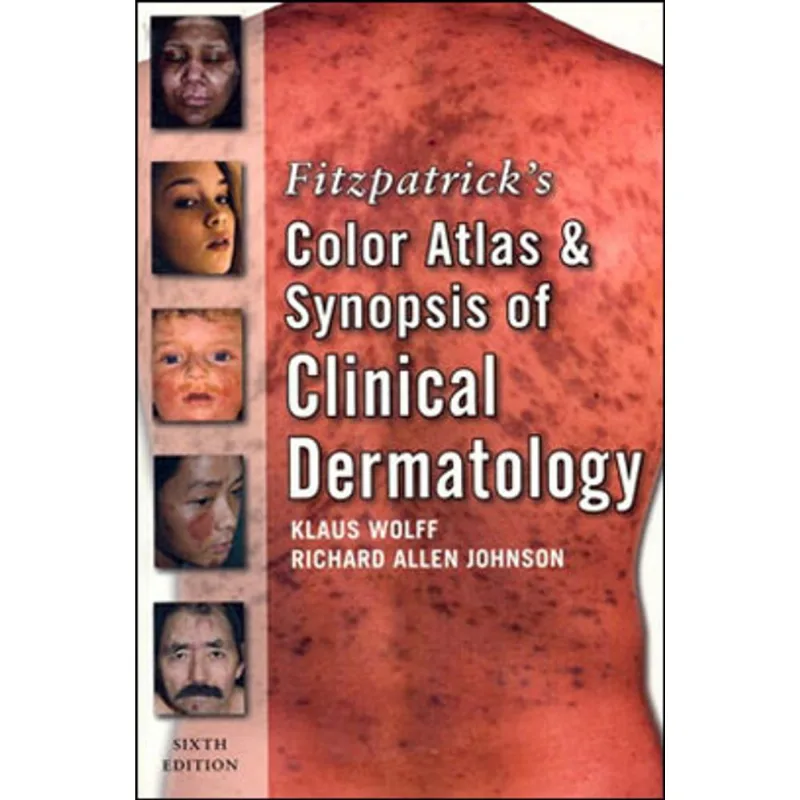 FITZPATRICK'S COLOR ATLAS AND SYNOPSIS OF CLINICAL DERMATOLOGY