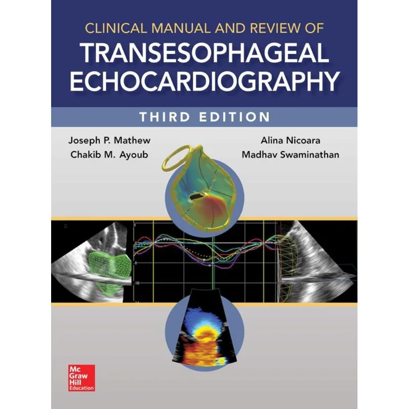 CLINICAL MANUAL AND REVIEW OF TRANSESOPHAGEAL ECHOCARDIOGRAPHY