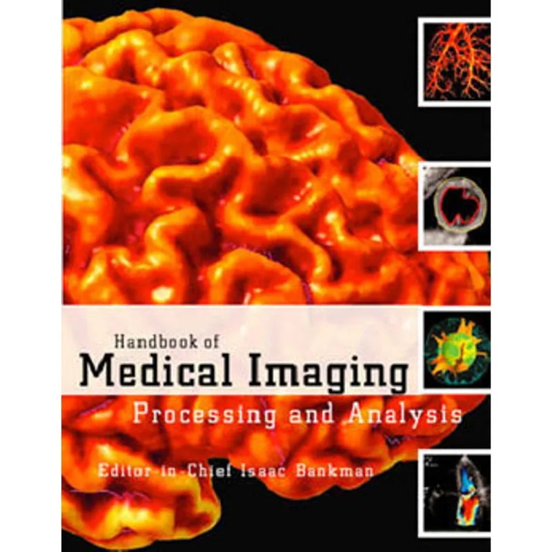 HANDBOOK OF MEDICAL IMAGING: PROCESSING AND ANALYSIS