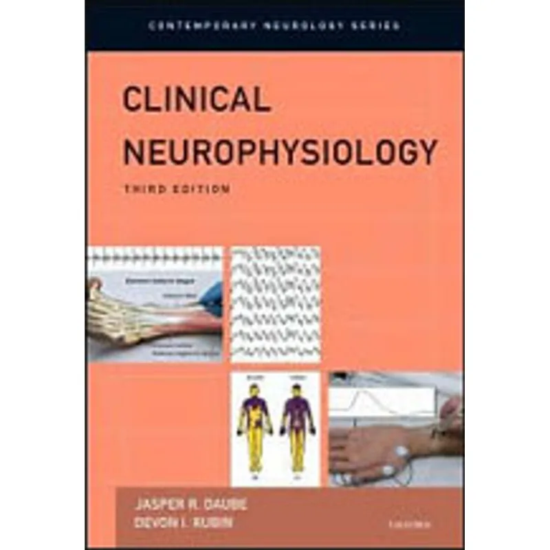CLINICAL NEUROPHSYIOLOGY