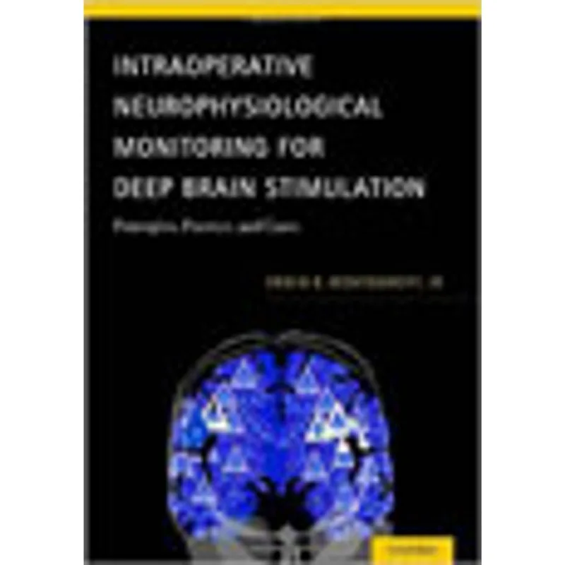 INTRAOPERATIVE NEUROPHYSIOLOGICAL MONITORING FOR DEEP BRAIN STIMULATION