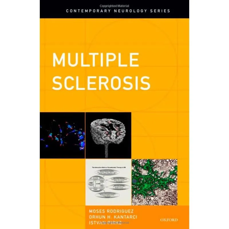 Livro Multiple Sclerosis