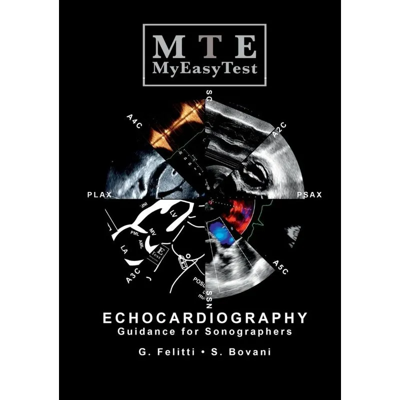 Echocardiography - MyEasyTest