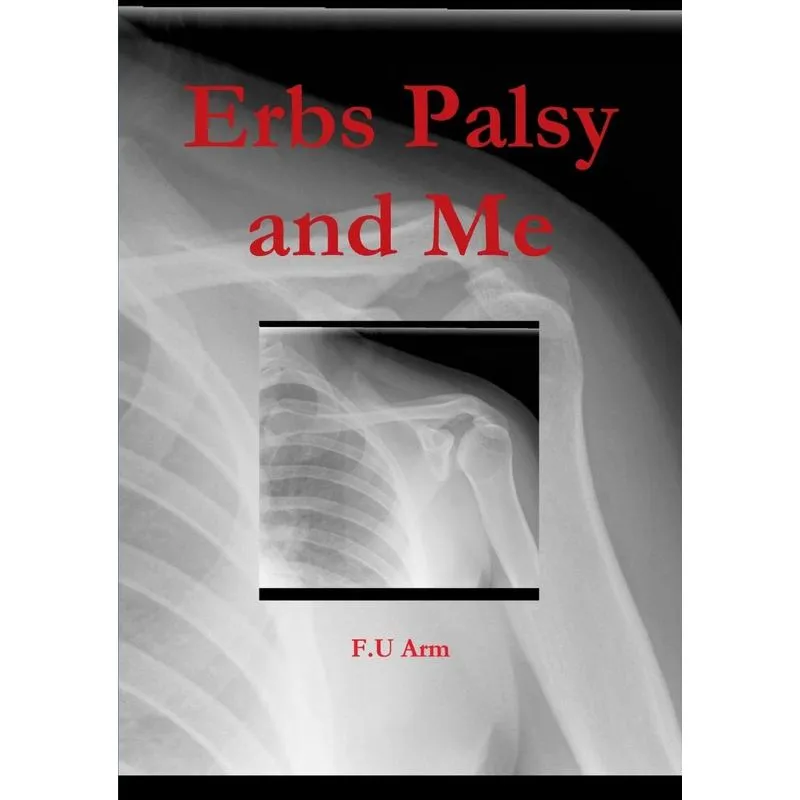 Erbs Palsy and Me
