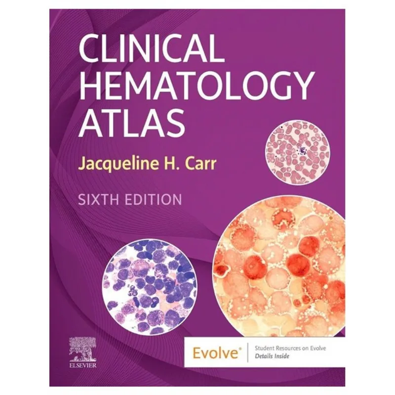 CLINICAL HEMATOLOGY ATLAS