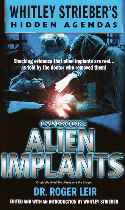 Casebook: Alien Implants STANDARD