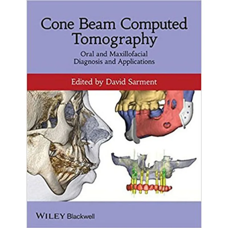 CONE BEAM COMPUTED TOMOGRAPHY