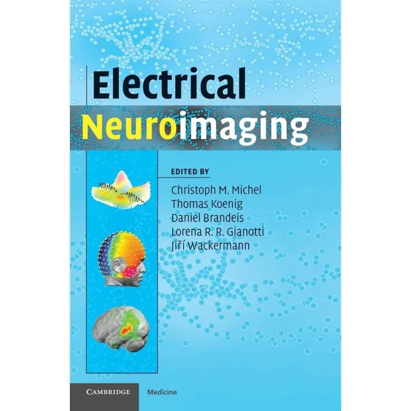 Electrical Neuroimaging