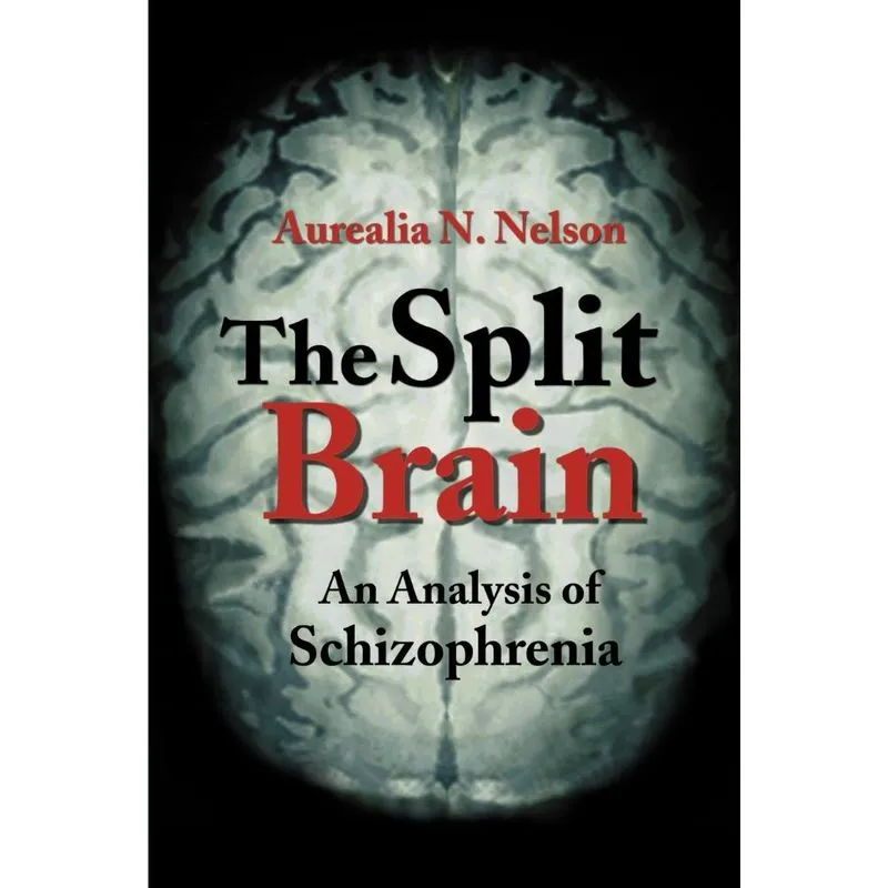 The Split Brain