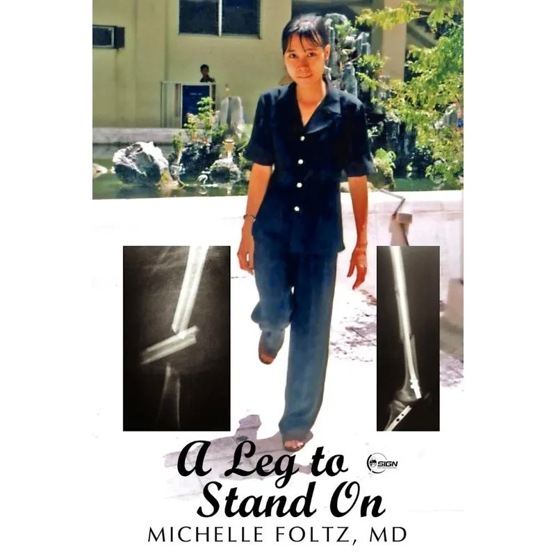A Leg to Stand On