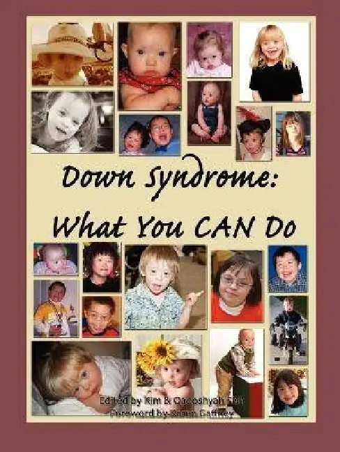 Down Syndrome: What You CAN Do Paperback