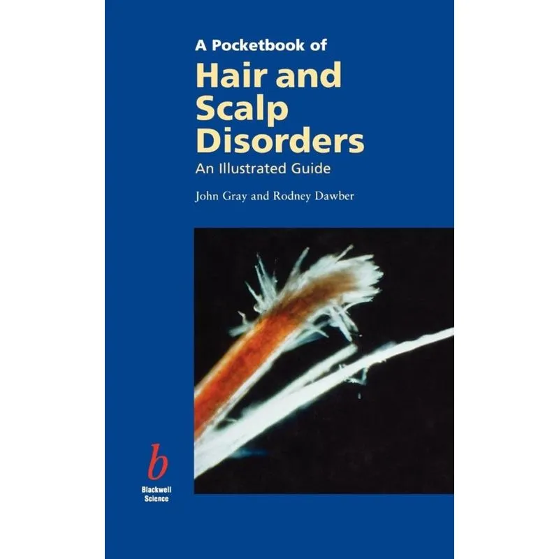Pocketbook of Hair and Scalp Disorders