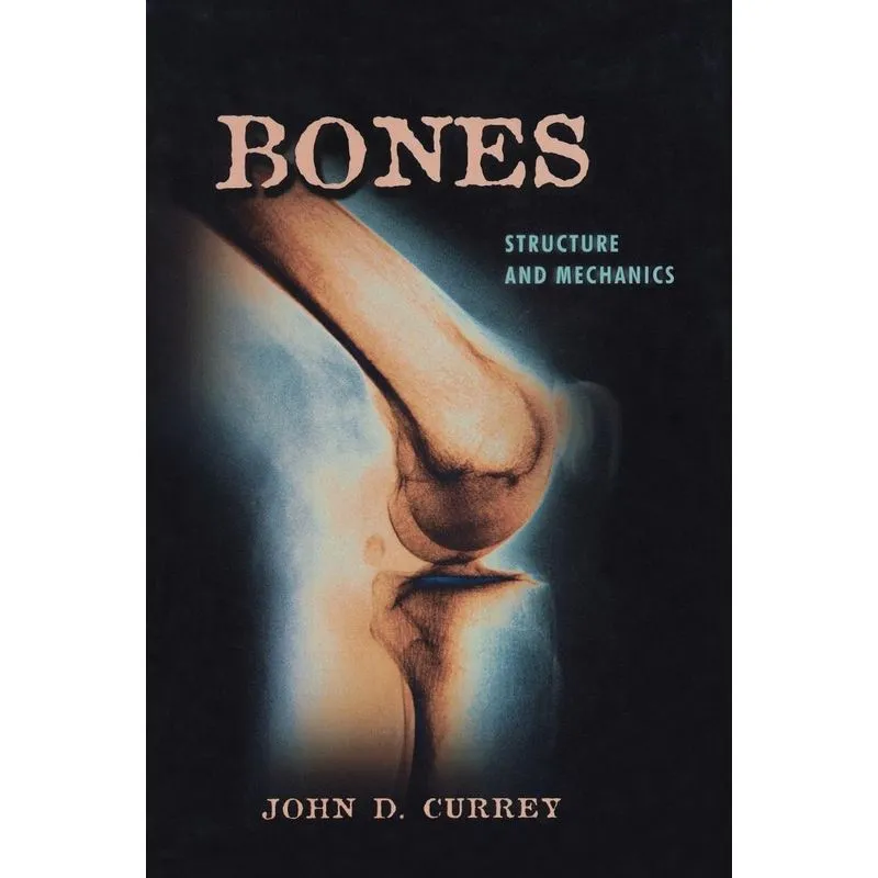 Bones