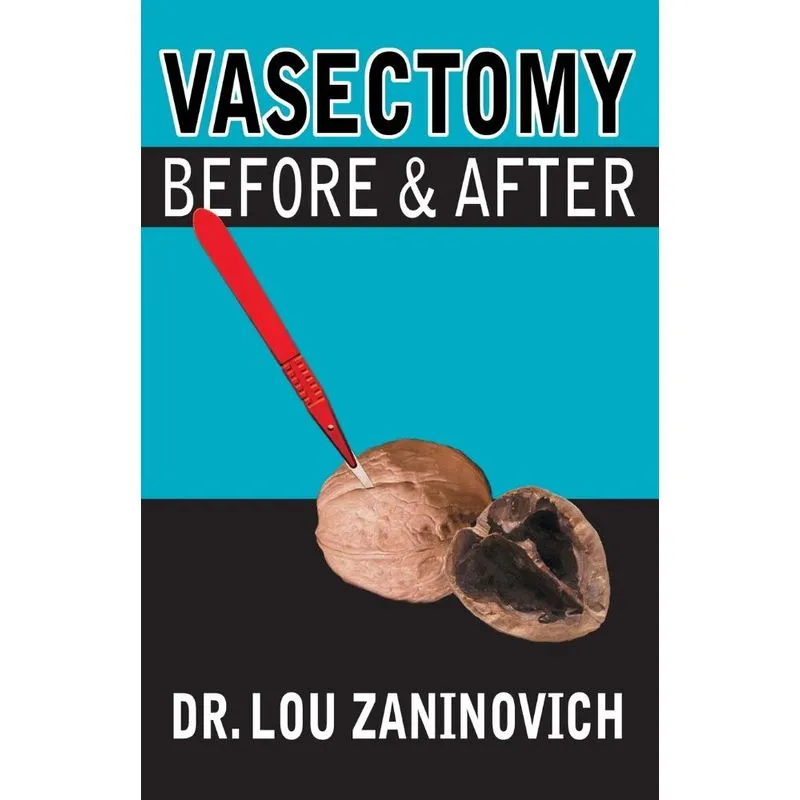 Vasectomy - Before and After