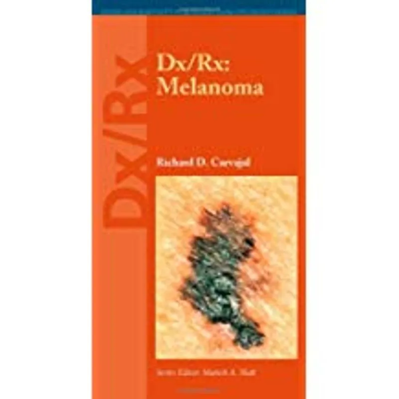 Dx/Rx: Melanoma