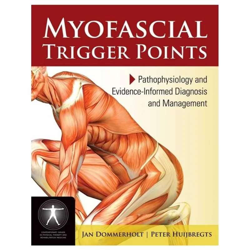 MYOFASCIAL TRIGGER POINTS