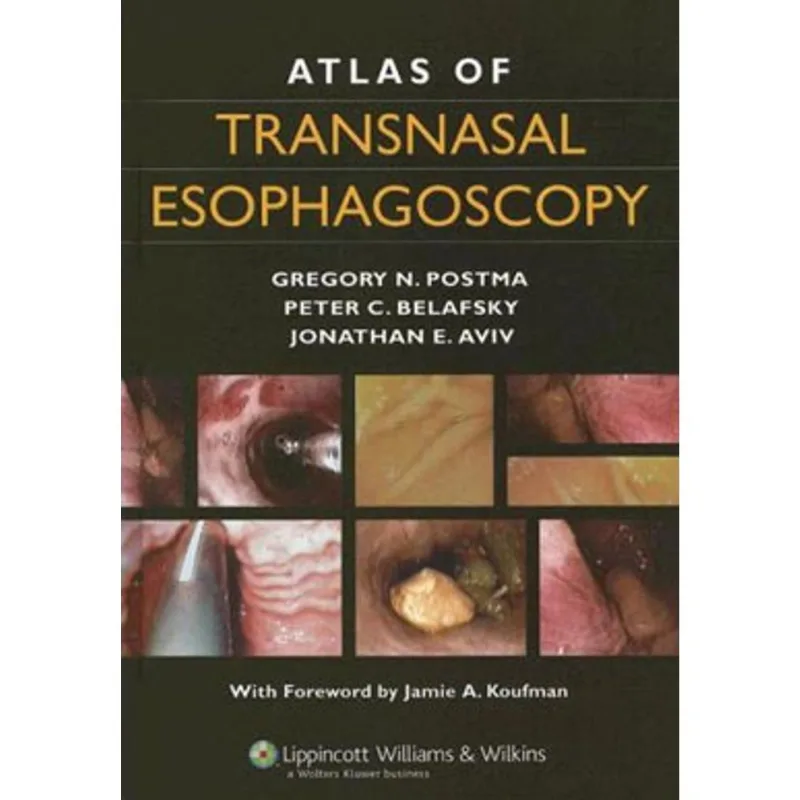 ATLAS OF TRANSNASAL ESOPHAGOSCOPY