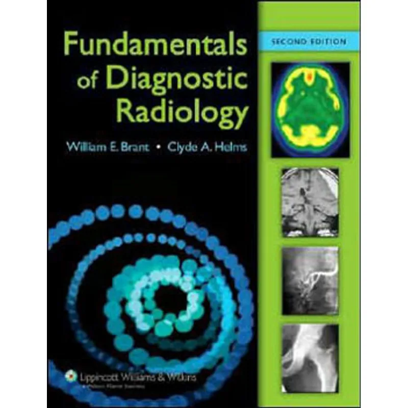 BRANT AND HELMS SOLUTION, THE - FUNDAMENTALS OF DIAGNOSTIC RADIOLOGY