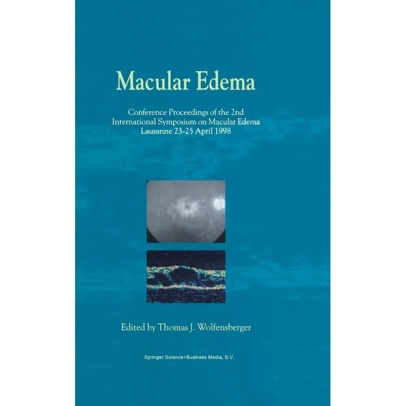 Macular Edema