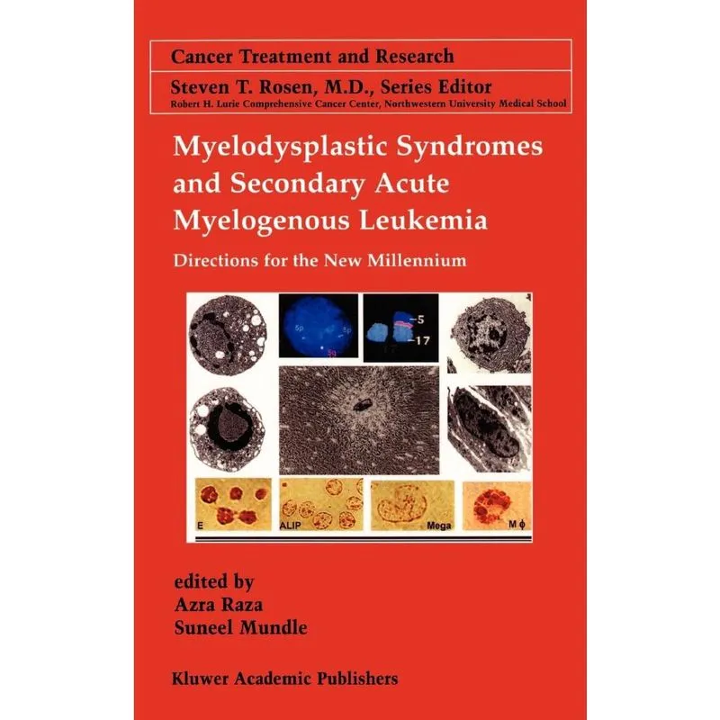Myelodysplastic Syndromes & Secondary Acute Myelogenous Leukemia
