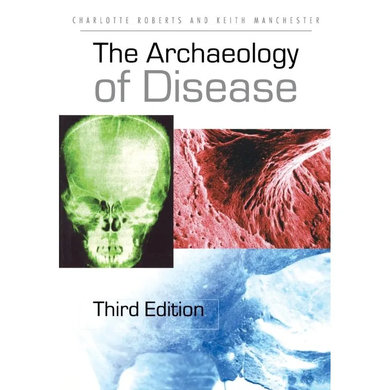 The Archaeology of Disease
