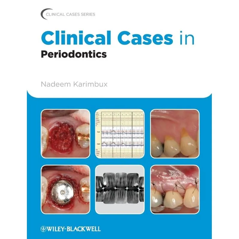 Clinical Cases in Periodontics