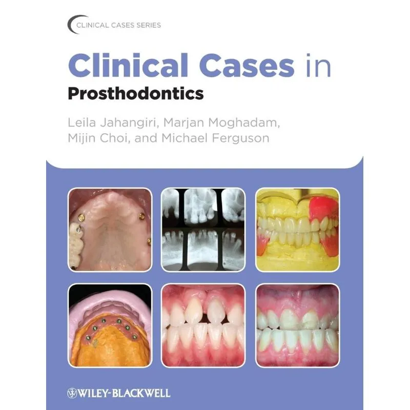Clinical Cases in Prosthodonti