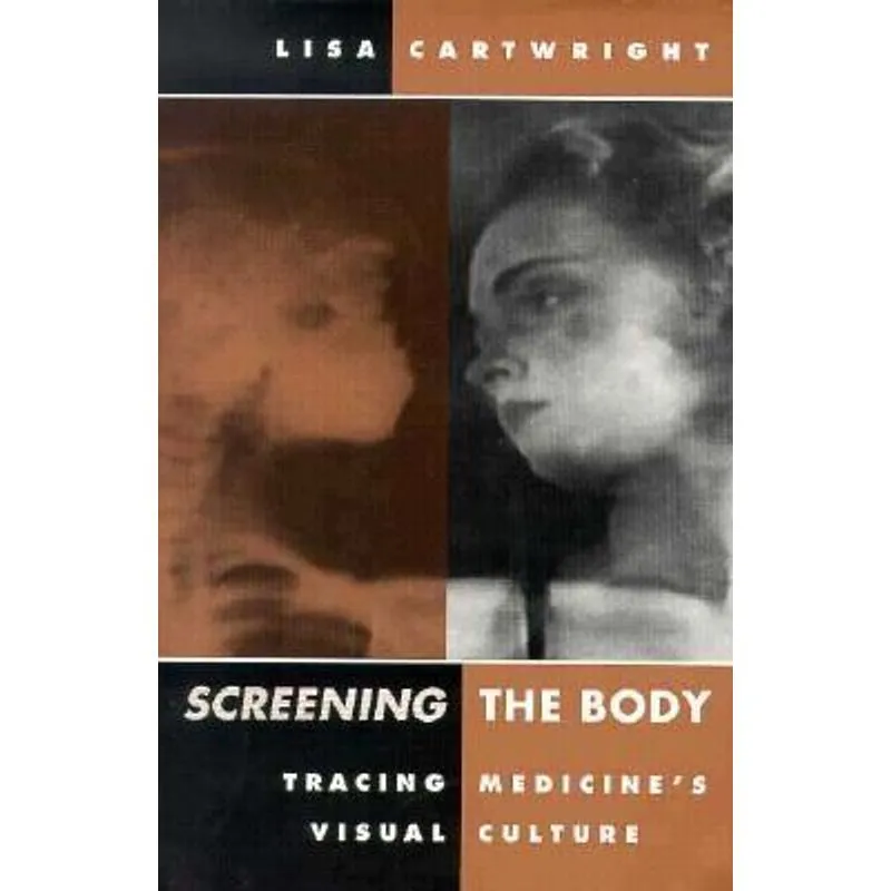 Screening the Body