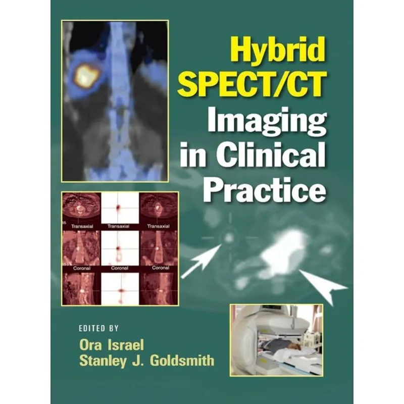 HYBRID SPECT/CT IMAGING IN CLINICAL PRACTICE