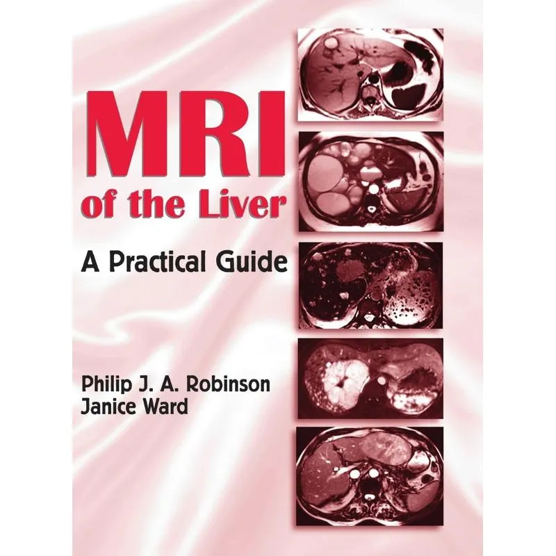 MRI of the Liver