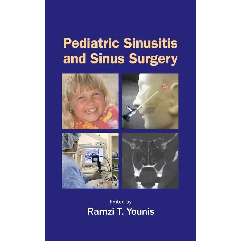 Pediatric Sinusitis and Sinus Surgery