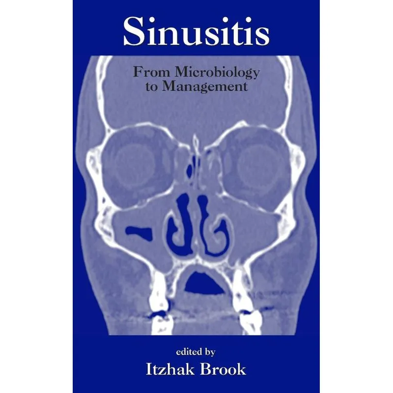 Sinusitis