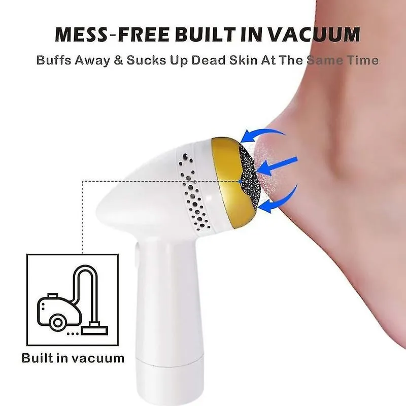 Ferramenta Elétrica Para Cuidados Com Os Pés - Removedor De Calos Com Vácuo