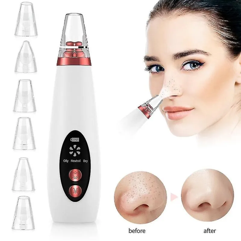 Limpadores faciais purificador de pele de cravo usb removedor de pontos pretos vácuo de poros cuidados com a pele acne poro uso de dispositivos de beleza