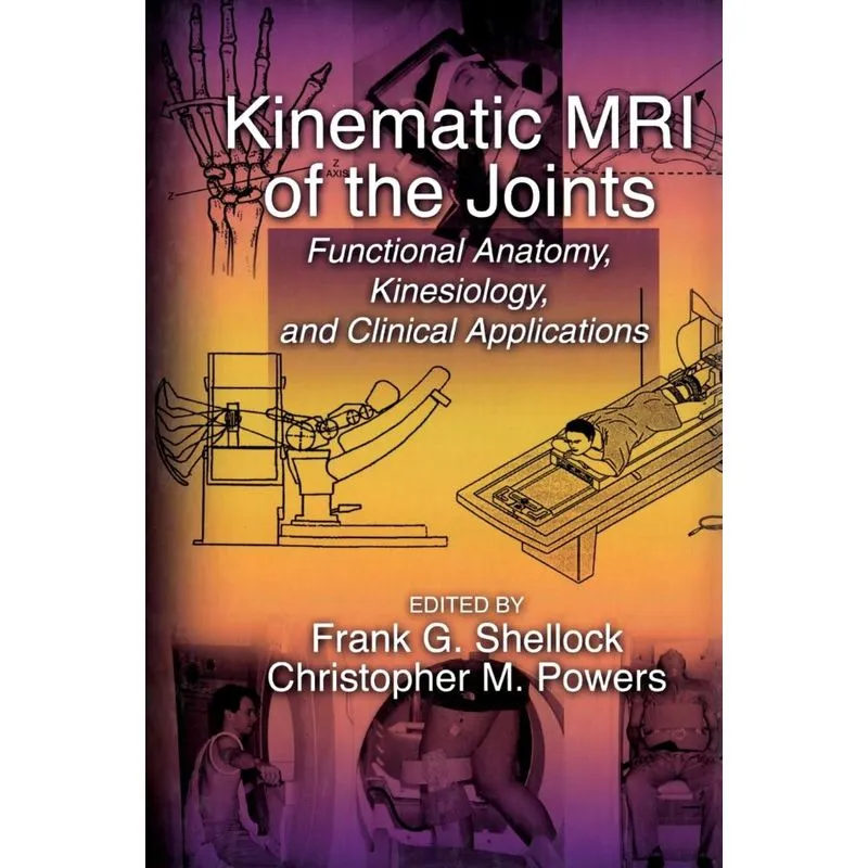 Kinematic MRI of the Joints