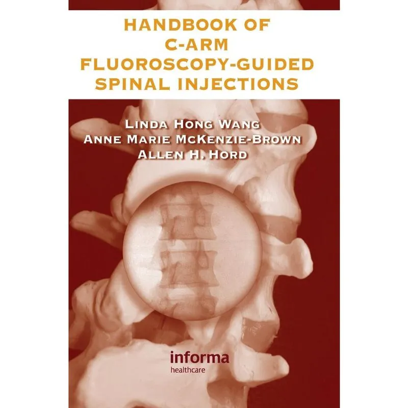 The Handbook of C-Arm Fluoroscopy-Guided Spinal Injections