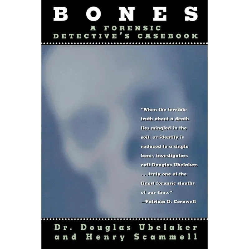 Bones