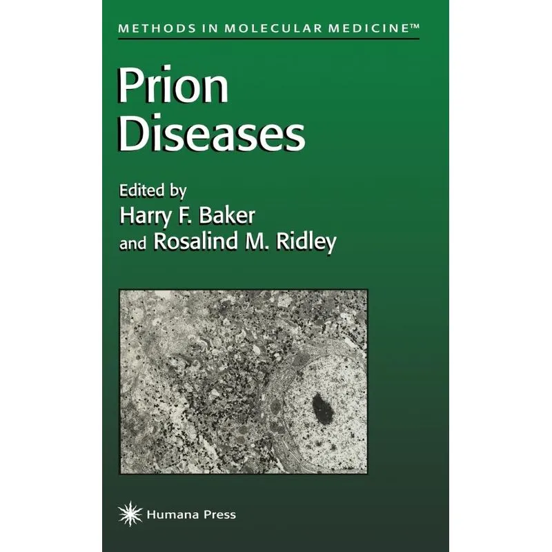 Prion Diseases