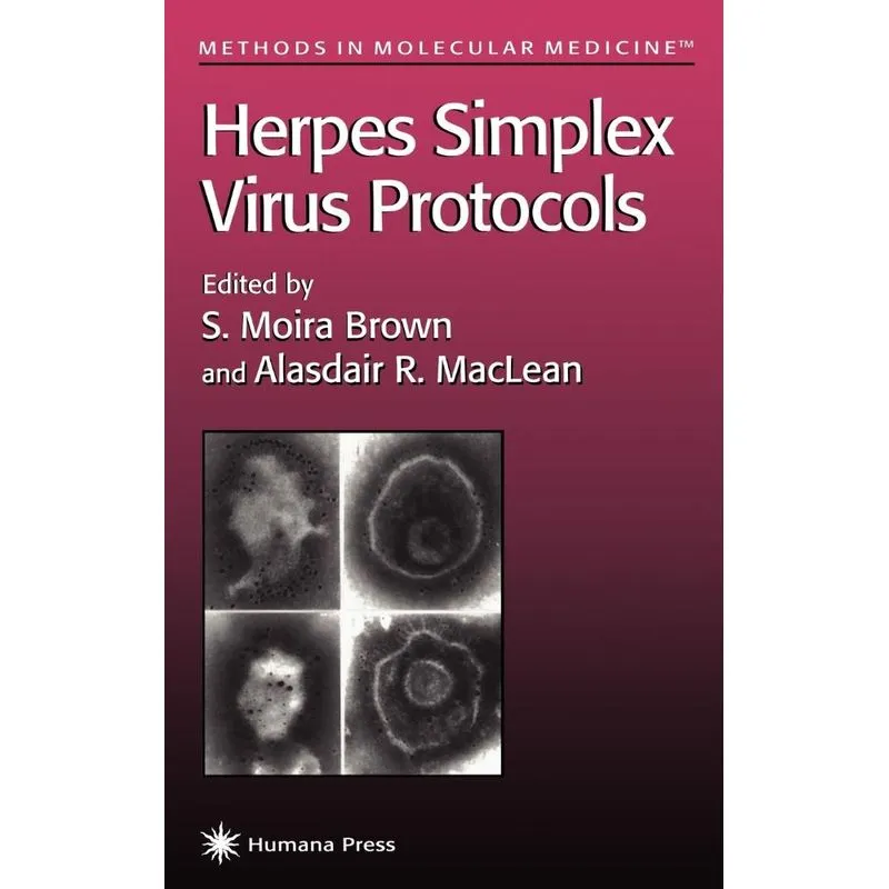 Herpes Simplex Virus Protocols