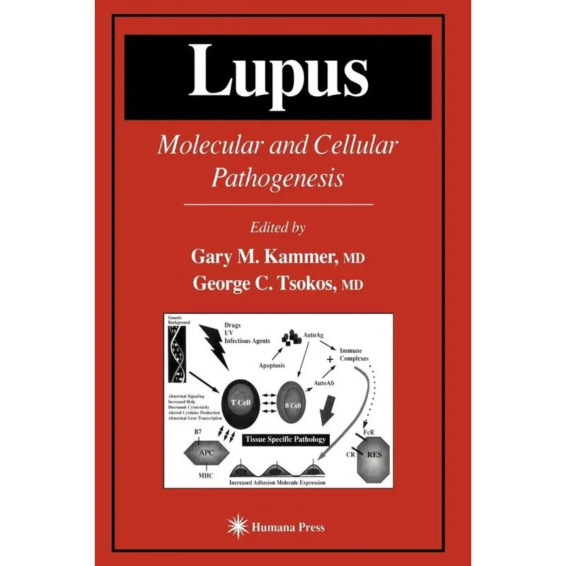 Lupus